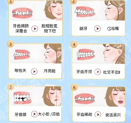 万州三峡医院牙齿矫正价格贵不贵？托槽矫正8k左右！隐形矫正1万左右起！