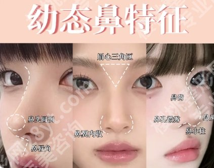重庆西南医院做鼻子怎么样？这几点一定要提前了解！真实测评