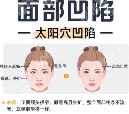 大连面部填充专家名单揭晓！赵穆欣、马希达、牟广隆上榜！点击一览