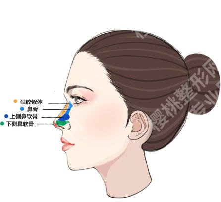 浙医二院整形科张梦文医生做鼻子技术如何？戳进来看口碑点评！