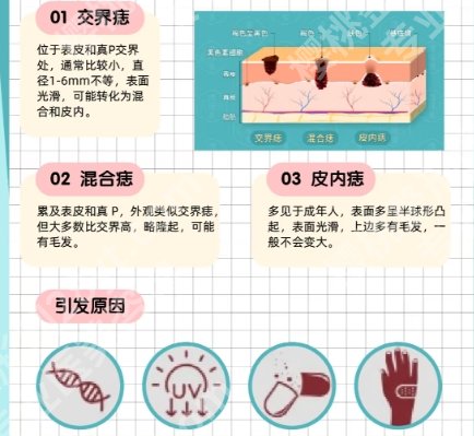 小榄人民医院激光点痣怎么样？网友亲身口碑附上！含人气医生