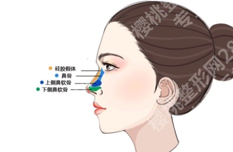 上海第一人民医院整形外科怎么样？鼻整形案例及术后注意事项分享！