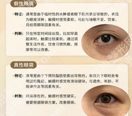吉大二院去眼袋多少钱？价格在6486-14700元不等！就诊必看