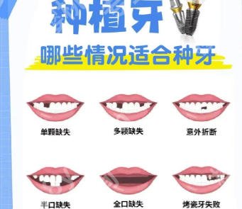 河源人民医院口腔科好不好？牙齿矫正案例参考！附详细流程