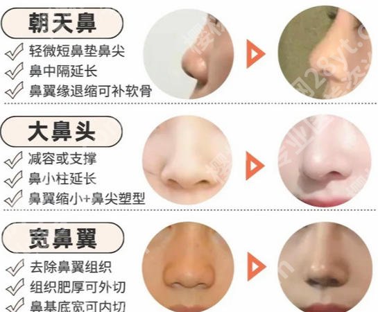 重医附二院整形科怎么样？真实口碑评价！当地网友力荐