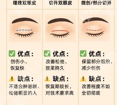 北京安贞医院美容科李彬彬怎么样？双眼皮、大腿环吸项目解析！