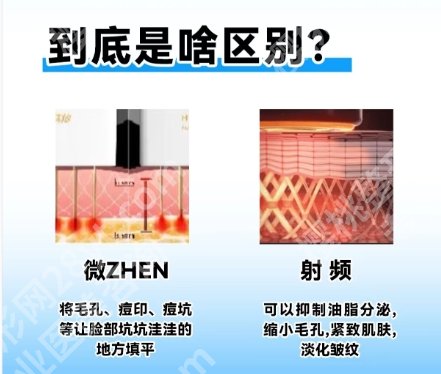 蚌埠三院光子嫩肤怎么样？真实口碑附上！案例图鉴赏
