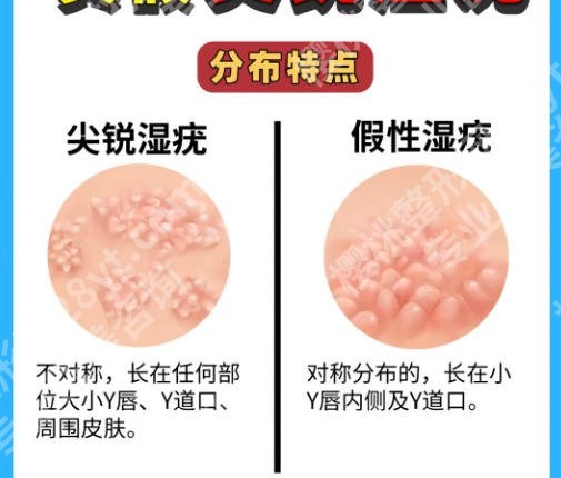 哈尔滨紧缩针哪里可以打啊？个个实力口碑兼具！