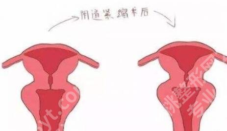 郑州紧缩针哪里可以打啊？2026医院排行榜名单更新！速速码住