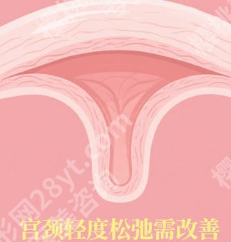 哈尔滨缩紧针哪里有卖？哈医大一院、大二院等性价比之选！