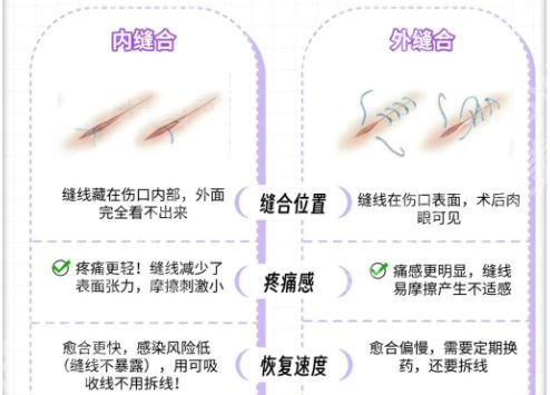 北京紧缩针在哪些医院可以打？2026医院排行榜名单出炉！