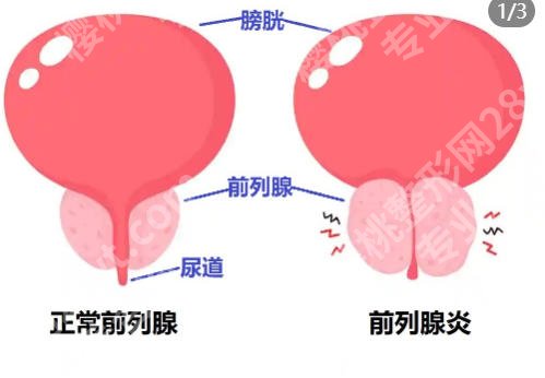 宁波延长手术哪里好？2026实测高口碑机构曝光