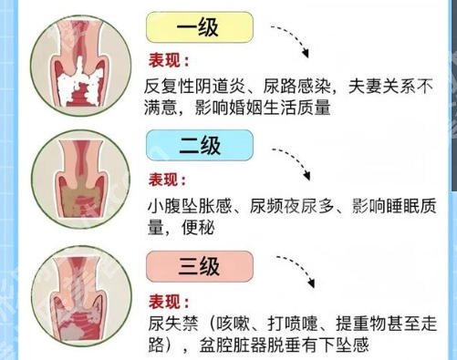 西安紧缩针新价格表更新！附2026最新医院榜单与医院详解