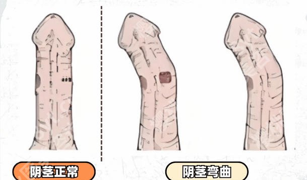 佛山增粗增长医院医生名单揭晓！何伟、杜永军等医生技术口碑好！