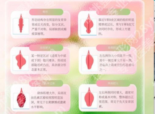 西安紧缩针多少钱一针啊？医院口碑点评来袭！