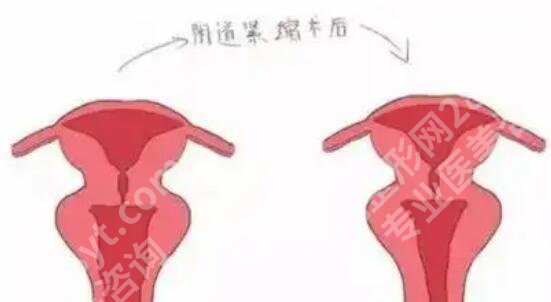 徐州紧缩针在哪里预约？盘点本地值得参考的美容院名单！避坑必看