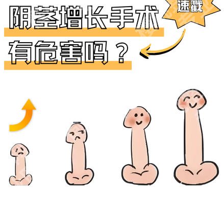 北京男人做延长手术大概多少钱呀？2026价目表更新！点击预览