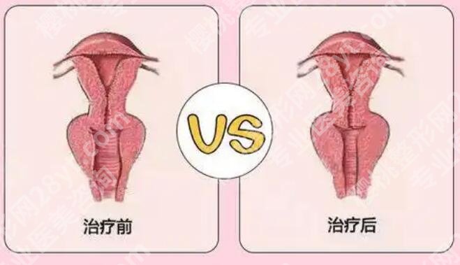 武汉紧缩针多少钱一支哪里可以打？2026价目表解析！就诊必看