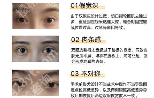 深圳眼睛修复比较好的医生有哪些？剖析了很多医生的资料