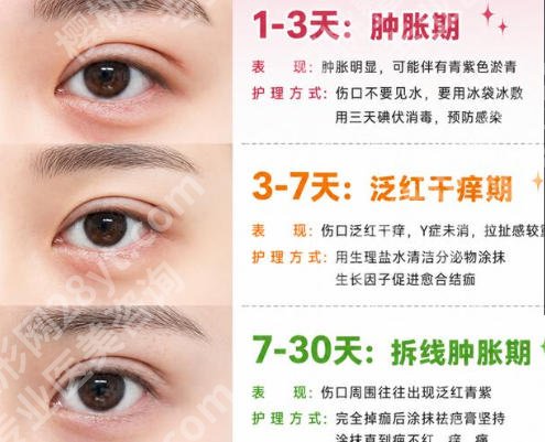 台州双眼皮修复哪里好?正规机构排行榜单公示！收藏这篇够用