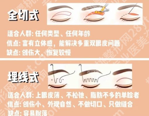 温州双眼皮修复厉害的三个医生名单汇总!徐海艇/李晓阳技术靠谱