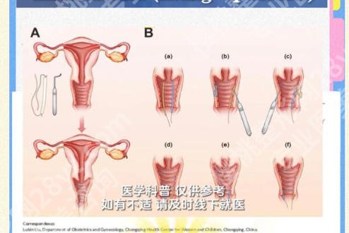 长沙adm紧缩针哪里可以打?修复技术过硬的医院盘点