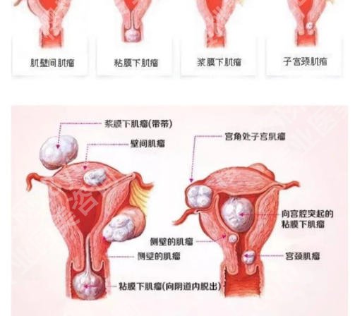 信阳紧缩针在哪里预约打?这几家医院技术不错!值得信赖