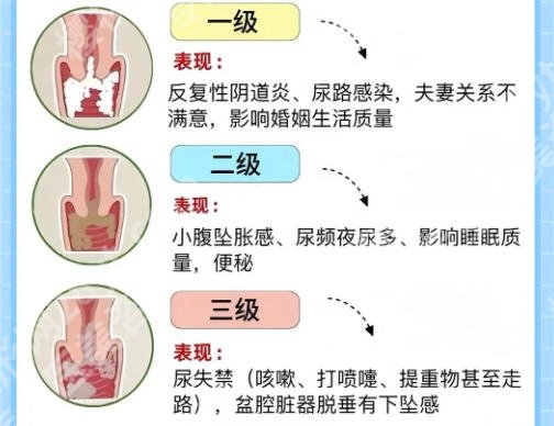 广州三甲医院做紧缩手术要多少钱？26年最新价格表一览！