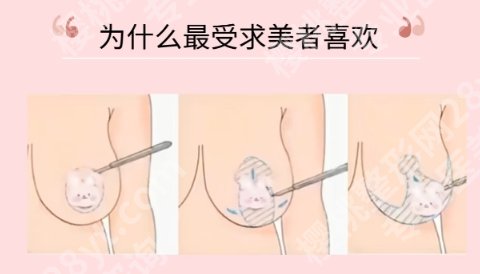 刘文阁医生口碑公布！医生简介及擅长项目技术评析！戳进来看