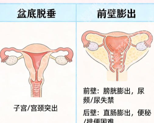 深圳哪家医院做完紧缩术好？新技术医院实力盘点！
