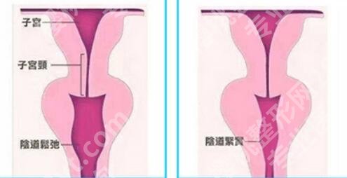 赣州adm紧缩针哪里可以打？2026医院排行榜揭晓！收藏再看