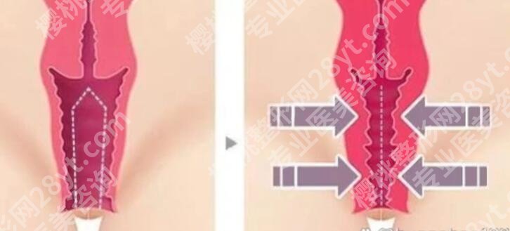 福州adm紧缩针哪里可以打?整理一批反馈不错的美容院名单!