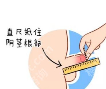 重庆大坪医院延长术如何？院内哪位医生技术好？附上案例