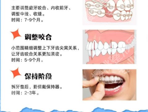 上海新华医院牙齿矫正好吗？专家及擅长项目起底