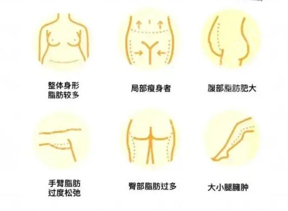 深圳人民医院抽脂技术好吗?人气医生名单公布！含医院信息