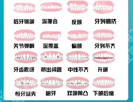 上海中山医院正颌手术价格贵不贵？正颌真实案例展示！