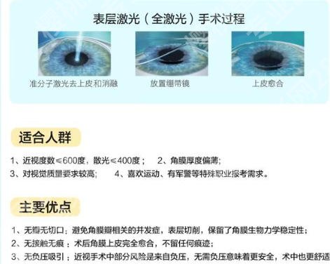 中山大学中山眼科中心做近视手术怎么样？附真实案例分享