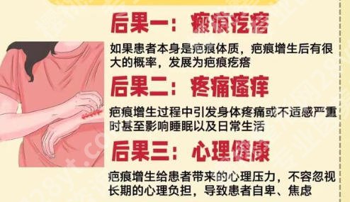 重庆新桥医院激光祛疤怎样？真实案例！见证TA的蜕变！