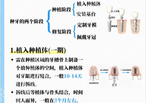 深圳市第二人民医院种植牙怎么样？公立医院技术稳！