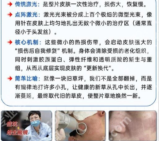 海南省人民医院点阵激光怎么样？认证专家权威发布