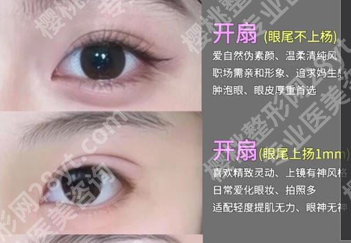 上海仁济医院整形科陆毅医生怎么样？擅长项目、案例效果曝光