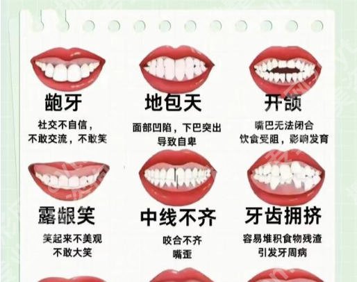 上海仁济医院牙齿矫正怎么样？医生信息与真实案例曝光