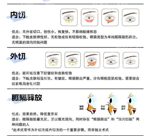 上海三甲医院祛眼袋怎么样？5家公立医院资料在线看