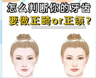 上海国际医学中心正颌手术费用表更新！沈国芳/史俊医生口碑好！