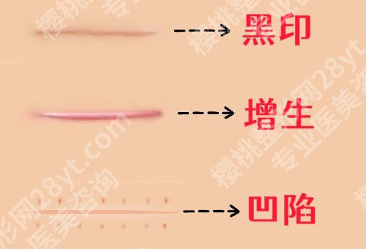 重庆西南医院祛疤痕怎么样？医生信息与擅长案例推荐！