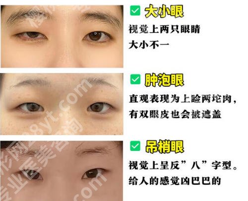 蚌埠第三人民医院割双眼皮好吗？项目推荐和科室实力分析