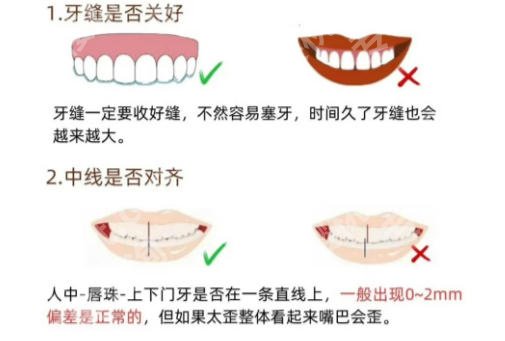 上海九院牙齿矫正挂什么科室？过来人实测攻略！