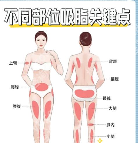 深圳人民医院抽脂是怎么收费？单部位23,000~33,000元左右！