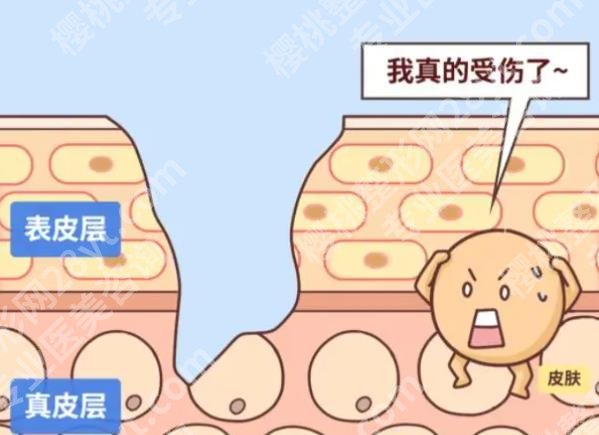 金华中心医院祛疤多少钱？去医院要准备多少预算？2026-8月更新价