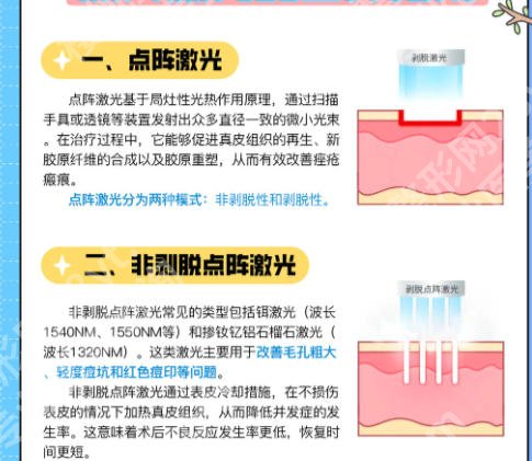 中山第二人民医院激光点阵怎么样？看医院专业团队介绍